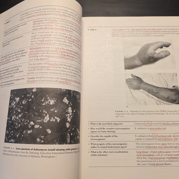 First Aid USMLE Step 1 Book Second Edition - Picture 2 of 10
